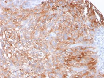 Anti-Uroplakin 1A (Urothelial Differentiation Marker) Monoclonal Antibody (Clone: UPK1A/2925)