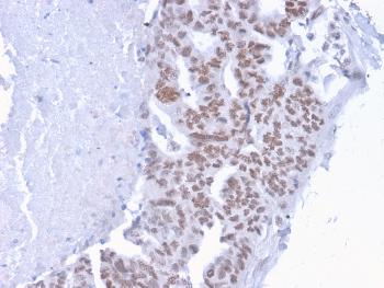 Anti-CHD4 Monoclonal Antibody (Clone: 3F2/4)