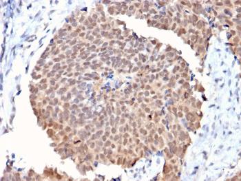 Anti-Fas (TNFRSF6) associated factor 1 Monoclonal Antibody (Clone: CPTC-FAF1-2)