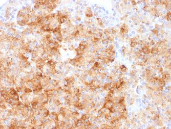 Anti-Chromogranin A / CHGA (Neuroendocrine Marker) Polyclonal Antibody