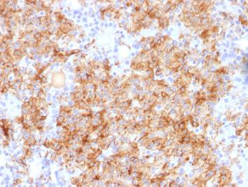 Anti-Chromogranin A / CHGA (Neuroendocrine Marker) Polyclonal Antibody