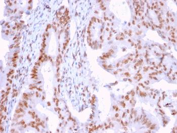 Anti-DMC1 Monoclonal Antibody (Clone: 2H12/4)