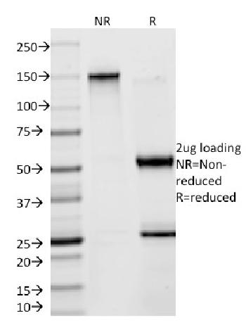 Anti-Creatine Kinase-BB (CK-BB) Monoclonal Antibody (Clone: 2ba6)