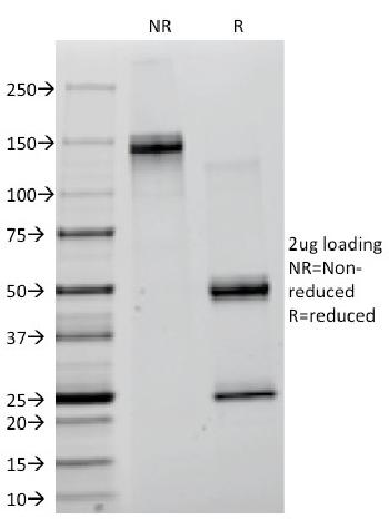 Anti-Creatine Kinase-BB (CK-BB) Monoclonal Antibody (Clone: CKB/1268)