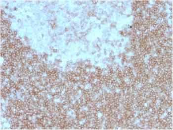 Anti-CD268 / BAFFR / TNFRSF13C Monoclonal Antibody (Clone: BAFFR/1557)