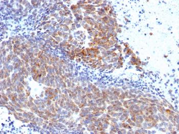 Anti-Topoisomerase (DNA) I, Mitochondrial (TOP1MT) Monoclonal Antibody (Clone: TOP1MT/568)