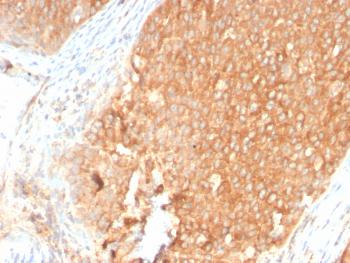 Anti-Topoisomerase I, Mitochondrial (TOP1MT) Monoclonal Antibody (Clone: TOP1MT/2883R)