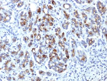 Anti-Alpha-1-Antichymotrypsin (SERPINA3) (Histiocytoma Marker) Monoclonal Antibody (Clone: AACT/1451)