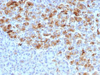 Anti-Alpha-1-Antichymotrypsin (SERPINA3) (Histiocytoma Marker) Monoclonal Antibody (Clone: AACT/1452)