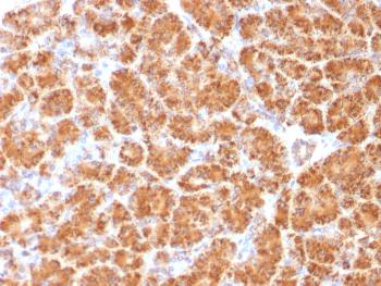 Anti-Clathrin, Light Chain Monoclonal Antibody (Clone: CLC/1421)