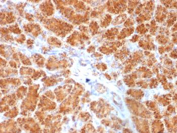 Anti-Clathrin, Light Chain Monoclonal Antibody (Clone: SPM174)