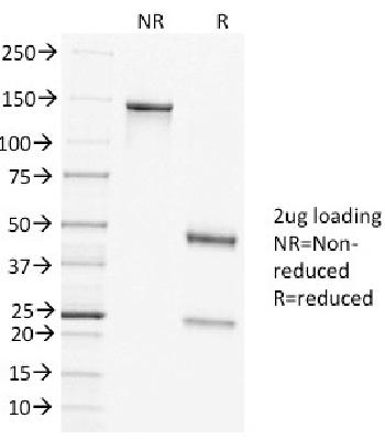 Anti-Clathrin, Heavy Chain Monoclonal Antibody (Clone: CLTC/1431)