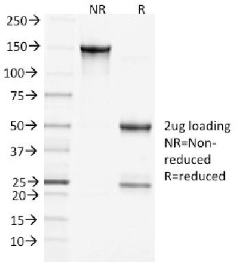 Anti-Clathrin, Heavy Chain Monoclonal Antibody (Clone: CHC/1432)