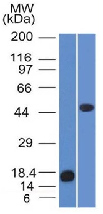 Anti-Adipophilin / Perilipin-2 (Marker of Lipid Accumulation) Monoclonal Antibody (Clone: ADFP/1365)