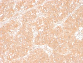 Anti-Adipophilin / Perilipin-2 (Marker of Lipid Accumulation) Monoclonal Antibody (Clone: ADFP/1366)