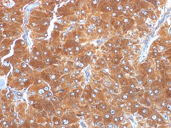 Anti-Adipophilin / Perilipin-2 (Marker of Lipid Accumulation) Monoclonal Antibody (Clone: ADFP/1494)