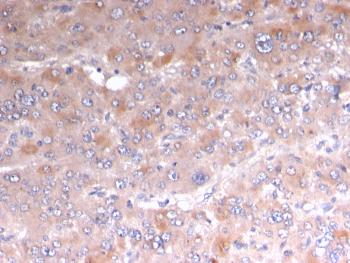 Anti-Adipophilin / Perilipin-2 (Marker of Lipid Accumulation) Monoclonal Antibody (Clone: rADFP/1493)