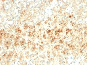 Anti-Adipophilin / Perilipin-2 (Marker of Lipid Accumulation) Monoclonal Antibody (Clone: ADFP/2755R)