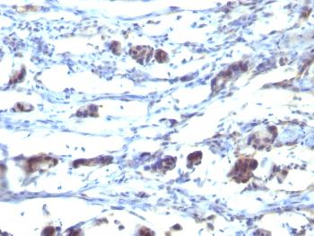 Anti-CD195 (CC-Chemokine Receptor 5) Monoclonal Antibody (Clone: 12D1)