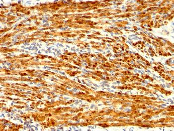 Anti-Calponin-1 (Smooth Muscle Marker) Monoclonal Antibody(Clone: CNN1/1408R)