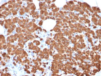 Anti-Carboxypeptidase A1 / CPA1 (Pancreatic Cancer Marker) Monoclonal Antibody(Clone: CPA1/2711)