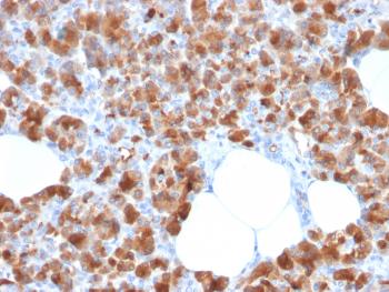 Anti-Carboxypeptidase A1 / CPA1 (Pancreatic Cancer Marker) Monoclonal Antibody(Clone: CPA1/2713)