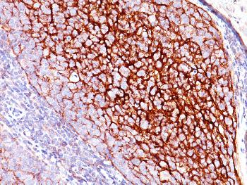 Anti-CD35 / CR1 (Follicular Dendritic Cell Marker) Monoclonal Antibody(Clone: E11)