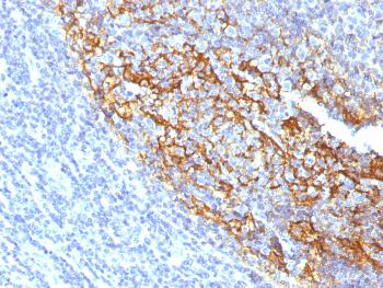 Anti-CD35 / CR1 (Follicular Dendritic Cell Marker) Monoclonal Antibody(Clone: To5)