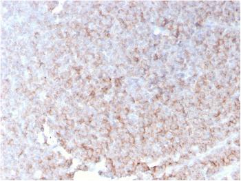 Anti-CD21 (Mature B-Cell & Follicular Dendritic Cell Marker) Monoclonal Antibody(Clone: rCR2/1952)