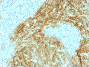 Anti-CD21 (Mature B-Cell & Follicular Dendritic Cell Marker) Monoclonal Antibody(Clone: CR2/1952)