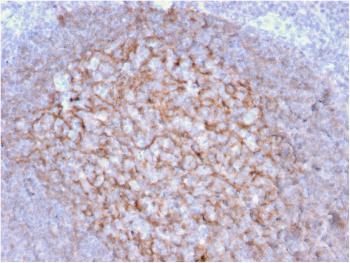 Anti-CD21 (Mature B-Cell & Follicular Dendritic Cell Marker) Monoclonal Antibody(Clone: CR2/1953)