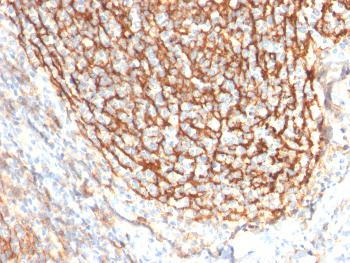 Anti-CD21 (Mature B-Cell & Follicular Dendritic Cell Marker) Monoclonal Antibody(Clone: CR2/2754)