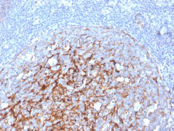 Anti-CD21 (Mature B-Cell & Follicular Dendritic Cell Marker) Monoclonal Antibody(Clone: CR2/3247)