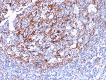 Anti-CD21 (Mature B-Cell & Follicular Dendritic Cell Marker) Monoclonal Antibody(Clone: CR2/3124R)