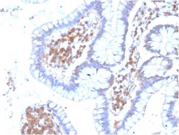 Anti-MAPK14 Monoclonal Antibody(Clone: CPTC-MAPK14-1)