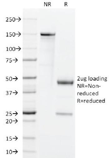 Anti-GM-CSF (Granulocyte/Macrophage - Colony Stimulating Factor) Monoclonal Antibody(Clone: BVD2-21C11)