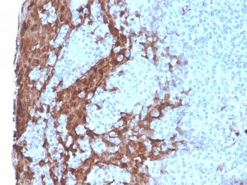 Anti-Granulocyte-Colony Stimulating Factor (G-CSF) Monoclonal Antibody(Clone: rCSF3/900)