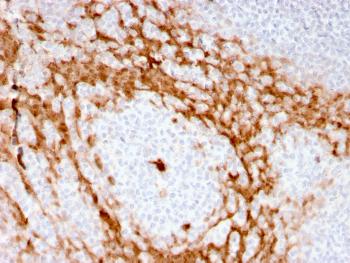 Anti-Granulocyte-Colony Stimulating Factor (G-CSF) Monoclonal Antibody(Clone: CSF3/3166R)