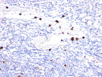 Anti-Cystatin A Monoclonal Antibody(Clone: CPTC-CSTA-1)