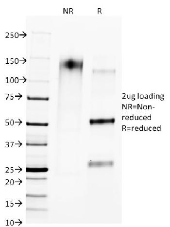 Anti-CTLA4 / CD152 (Negative Regulator of T-Cells) Monoclonal Antibody(Clone: L4P2F5.F10)