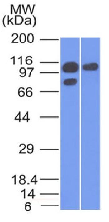 Anti-Catenin, alpha-1 (CTNNA1) Monoclonal Antibody(Clone: 1G5)