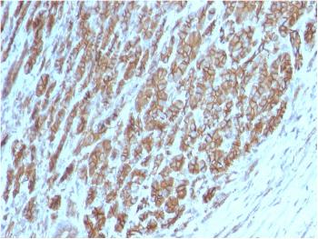 Anti-Catenin, beta (p120) Monoclonal Antibody(Clone: CTNNB1/2098)