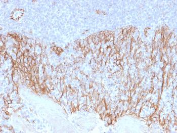 Anti-Catenin, beta (p120) Monoclonal Antibody(Clone: CTNNB1/2099)