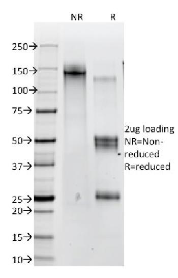 Anti-Catenin, beta (p120) Monoclonal Antibody(Clone: 12F7)