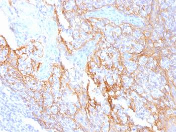 Anti-Catenin, beta (p120) Monoclonal Antibody(Clone: 15B8)