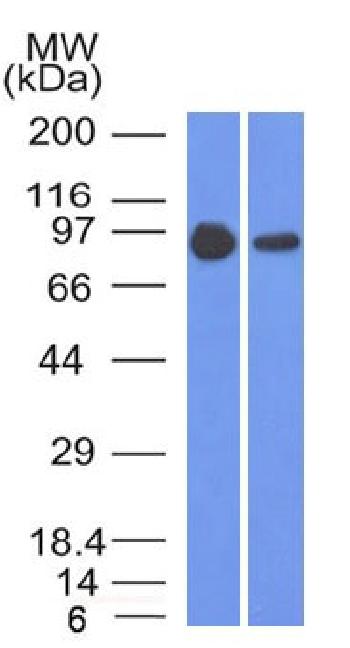 Anti-Catenin, beta (p120) Monoclonal Antibody(Clone: 5H10)