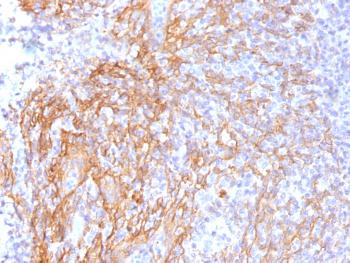 Anti-Catenin, beta (p120) Monoclonal Antibody(Clone: 6F9)