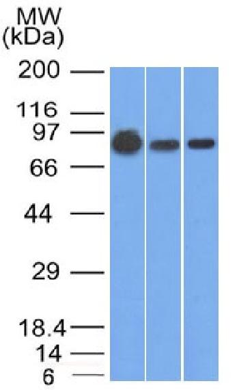 Anti-Catenin, beta (p120) Monoclonal Antibody(Clone: 9F2)