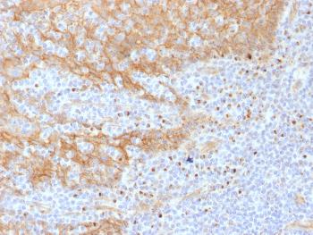 Anti-Catenin, beta (p120) Monoclonal Antibody(Clone: CTNNB1/1508)