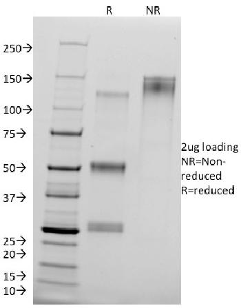 Anti-Catenin, delta-1 (CTNND1) (pTyr96) Monoclonal Antibody(Clone: 25a)